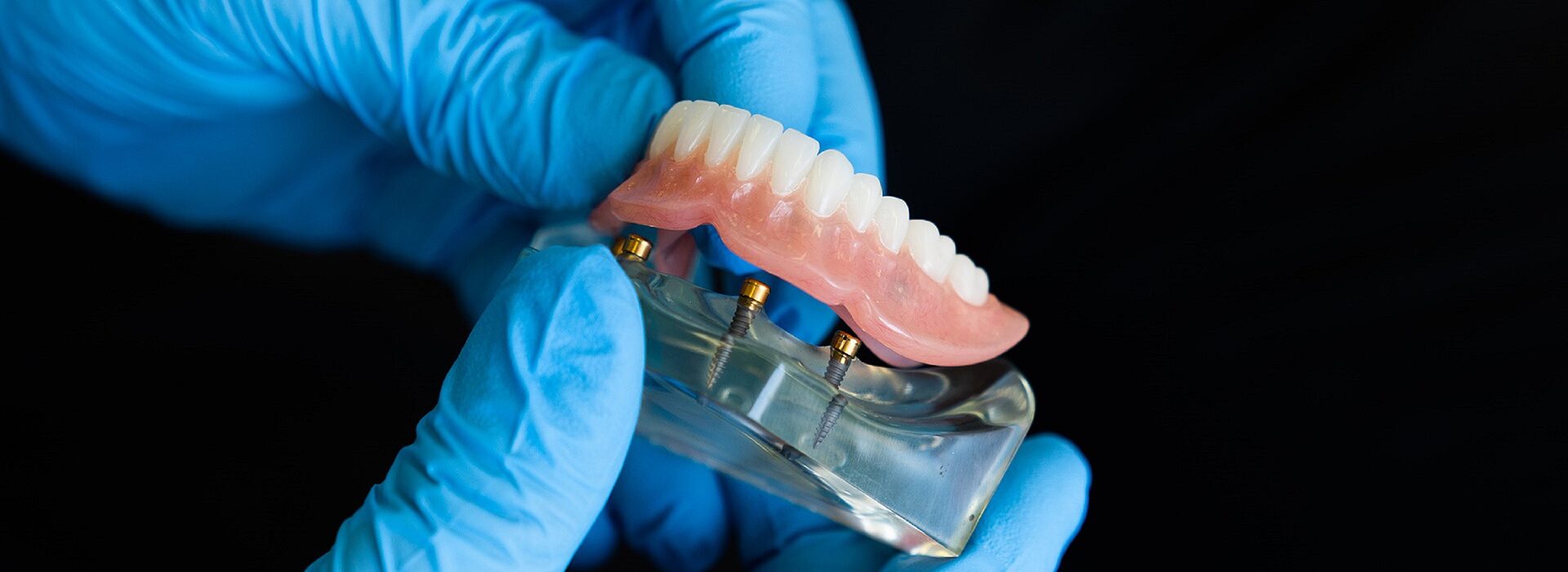 protesi dentale